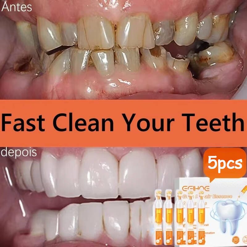 Teeth Whitening Baking Soda - Soro de goma para reparação rápida,