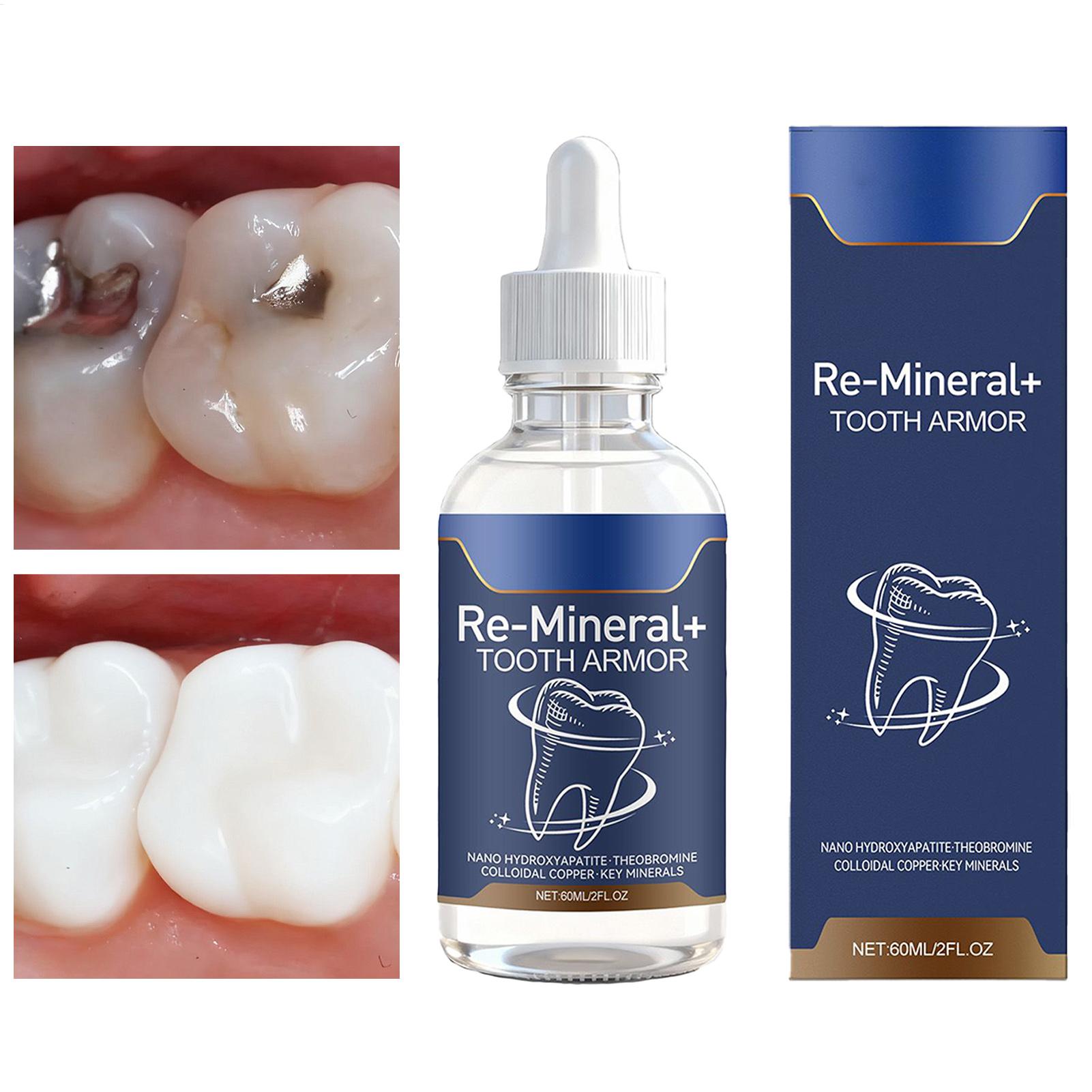 Teeth Whitening Gum - Líquido de Limpeza Dental 60ml Remove