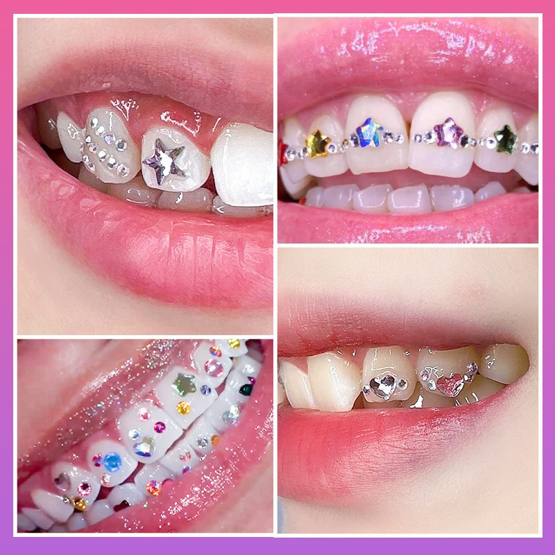 NOVO Kit Profissional de Joias - Tooth Gem Kit avaliação e preço