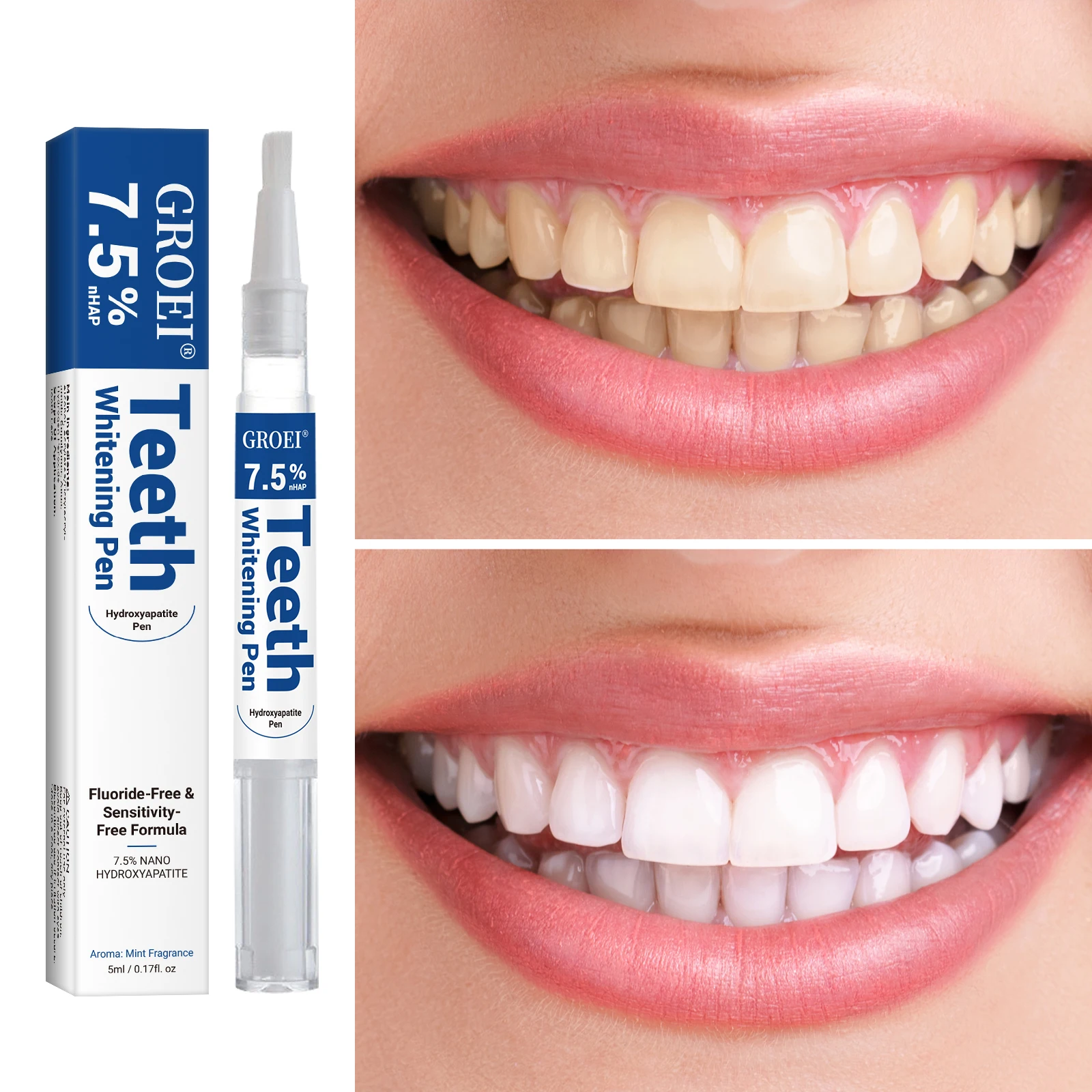 Caneta branqueadora de dente h - Teeth Whitening With Peroxide avaliação e preço
