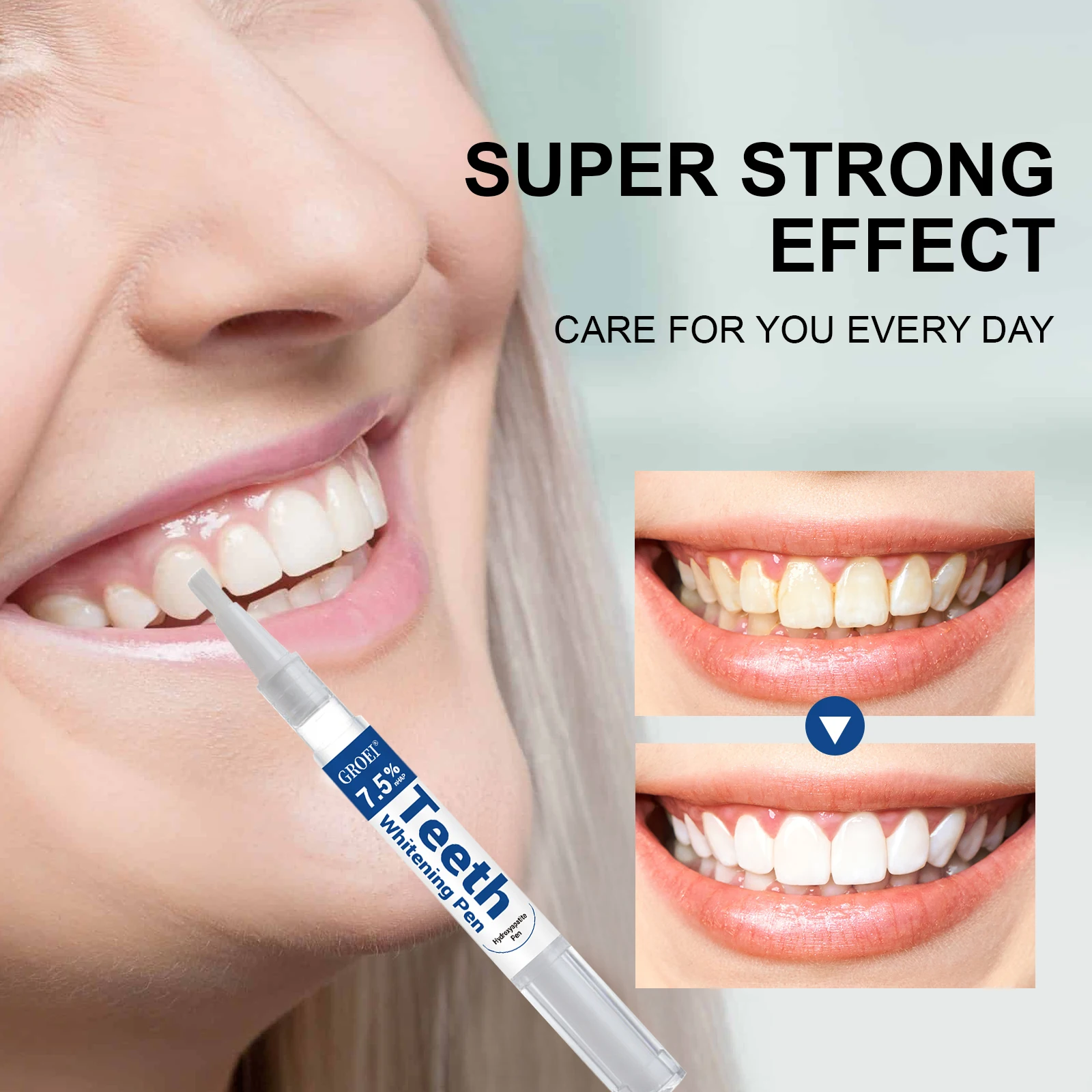 Caneta branqueadora de dente h - Teeth Whitening With Peroxide avaliação e preço