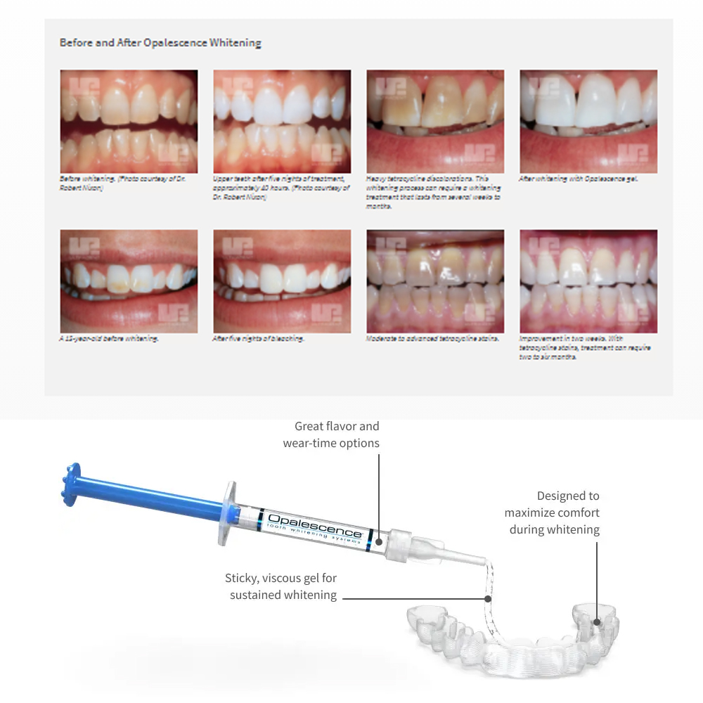 Opalescência Whitening Gel Kit - Teeth Whitening With Peroxide avaliação e preço
