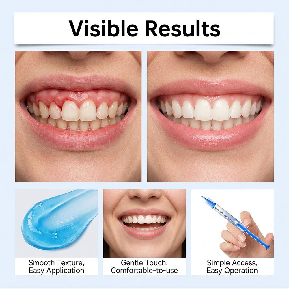 3 unidades de gel reparador pa - Teeth Whitening Gum avaliação e preço