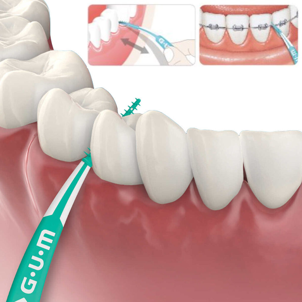 Goma picaretas suaves avançado - Teeth Whitening In Japan avaliação e preço