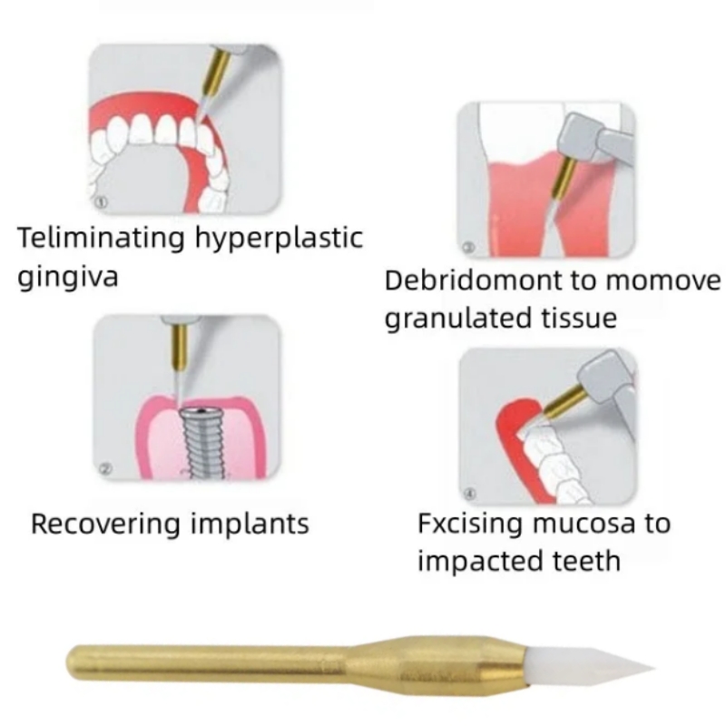 Dental macio trimmer burs cirú - Teeth Whitening Gum avaliação e preço